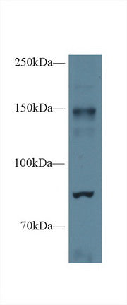 Polyclonal Antibody to Nitric Oxide Synthase 2, Inducible (NOS2)