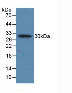 Polyclonal Antibody to Prolactin (PRL)