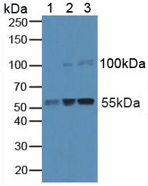 Polyclonal Antibody to Caspase 8 (CASP8)