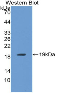 Polyclonal Antibody to Receptor Activator Of Nuclear Factor Kappa B Ligand (RANkL)