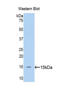 Polyclonal Antibody to Mannose Associated Serine Protease 2 (MASP2)