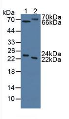 Polyclonal Antibody to Mannose Associated Serine Protease 2 (MASP2)