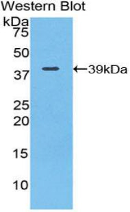 Polyclonal Antibody to Complement Component 3 (C3)