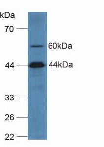 Polyclonal Antibody to Complement Component 2 (C2)