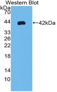 Polyclonal Antibody to Parathyroid Hormone (PTH)