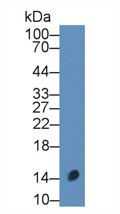 Polyclonal Antibody to Calcitonin Gene Related Peptide (CGRP)