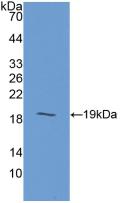 Polyclonal Antibody to Gastric Inhibitory Polypeptide (GIP)