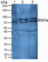 Polyclonal Antibody to Cluster Of Differentiation 26 (CD26)