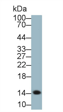 Polyclonal Antibody to Serum Amyloid A (SAA)