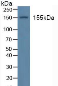 Polyclonal Antibody to Insulin Receptor (INSR)