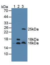 Polyclonal Antibody to Cystatin C (Cys-C)