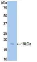 Polyclonal Antibody to Cystatin C (Cys-C)