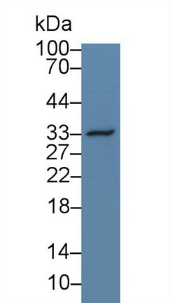 Polyclonal Antibody to Osteopontin (OPN)