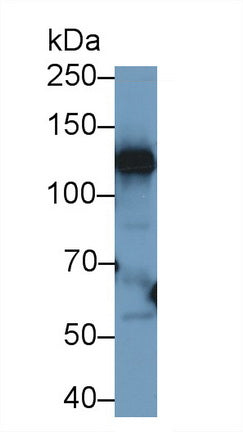 Polyclonal Antibody to Ceruloplasmin (CP)