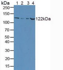 Polyclonal Antibody to Ceruloplasmin (CP)