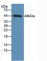 Polyclonal Antibody to Tumor Protein p53 (P53)