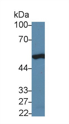 Polyclonal Antibody to Tumor Protein p53 (P53)