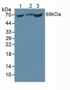 Polyclonal Antibody to Phosphoenolpyruvate Carboxykinase 1, Soluble (PCK1)