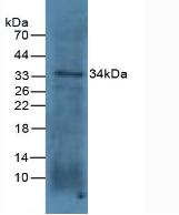 Polyclonal Antibody to Podocin (PDCN)