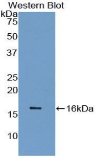 Polyclonal Antibody to Gamma-synuclein (SNCG)