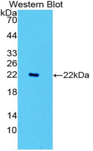 Polyclonal Antibody to Neutrophil Specific Antigen 1 (NB1)