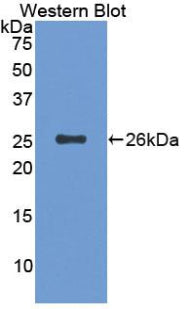 Polyclonal Antibody to Cluster Of Differentiation 6 (CD6)