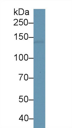 Polyclonal Antibody to L1-Cell Adhesion Molecule (L1CAM)