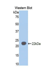 Polyclonal Antibody to Sialic Acid Binding Ig Like Lectin 5 (SIGLEC5)