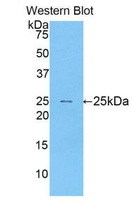 Polyclonal Antibody to Sialoadhesin (SN)