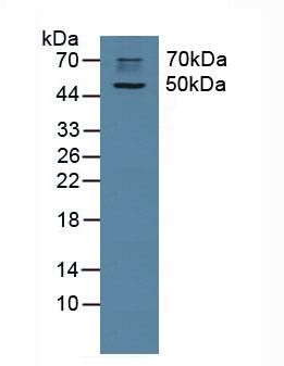 Polyclonal Antibody to Cholinergic Receptor, Muscarinic 1 (CHRM1)