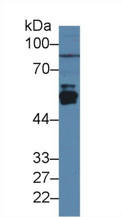 Polyclonal Antibody to Cytochrome P450 2E1 (CYP2E1)