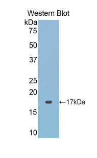Polyclonal Antibody to Acid Phosphatase 1 (ACP1)