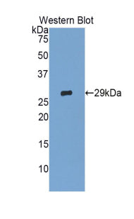 Polyclonal Antibody to Glypican 4 (GPC4)