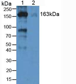 Polyclonal Antibody to Alpha-2-Macroglobulin (a2M)