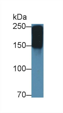 Polyclonal Antibody to Alpha-2-Macroglobulin (a2M)