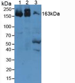 Polyclonal Antibody to Alpha-2-Macroglobulin (a2M)