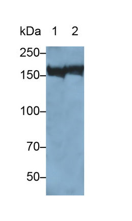 Polyclonal Antibody to Alpha-2-Macroglobulin (a2M)