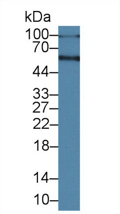 Polyclonal Antibody to Albumin (ALB)