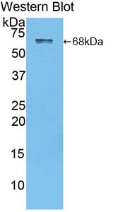 Polyclonal Antibody to Albumin (ALB)