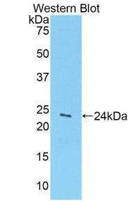 Polyclonal Antibody to Glypican 1 (GPC1)