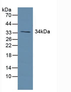 Polyclonal Antibody to Growth Hormone Receptor (GHR)