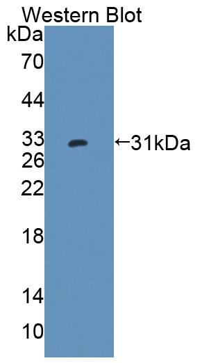 Polyclonal Antibody to Protein Tyrosine Phosphatase Receptor Type K (PTPRK)