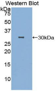 Polyclonal Antibody to Caspase Activated DNase (CAD)
