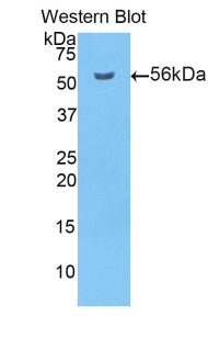 Polyclonal Antibody to Protein Disulfide Isomerase (PDI)