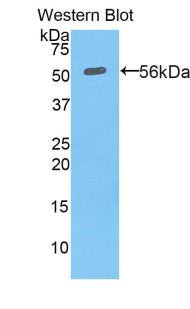 Polyclonal Antibody to Protein Disulfide Isomerase (PDI)