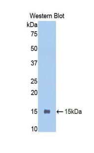 Polyclonal Antibody to Polymeric Immunoglobulin Receptor (PIGR)