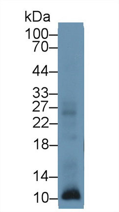 Polyclonal Antibody to S100 Calcium Binding Protein A12 (S100A12)