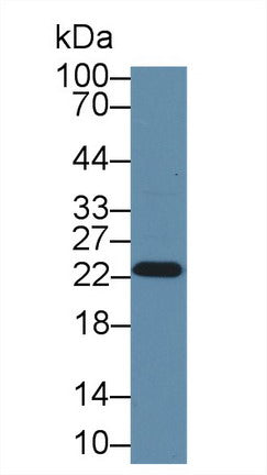Polyclonal Antibody to Glutathione S Transferase Pi (GSTp)