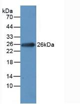 Polyclonal Antibody to Myosin Light Chain 1 (MYL1)