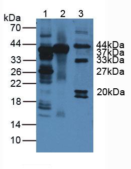 Polyclonal Antibody to Arginase (ARG)